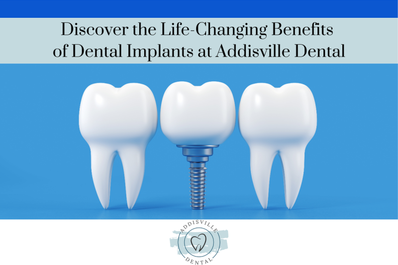 Discover the Life-Changing Benefits of Dental Implants at Addisville Dental